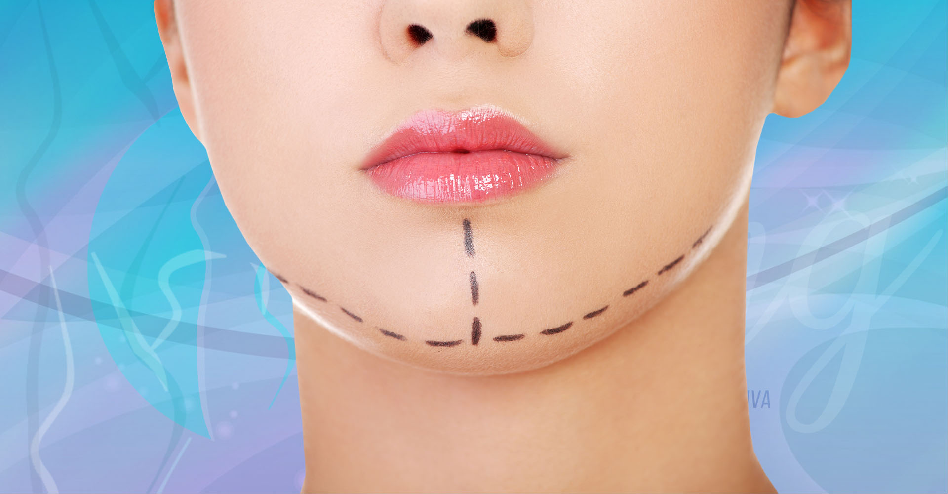 Cirugia plastica y reconstructiva